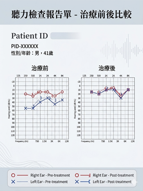 甚麼是突發性耳聾? 甚麼是突發性耳聾?